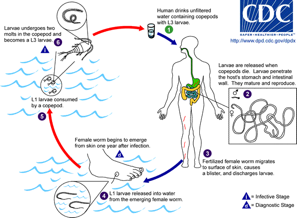 Life cycle of Dracunculus medinensis