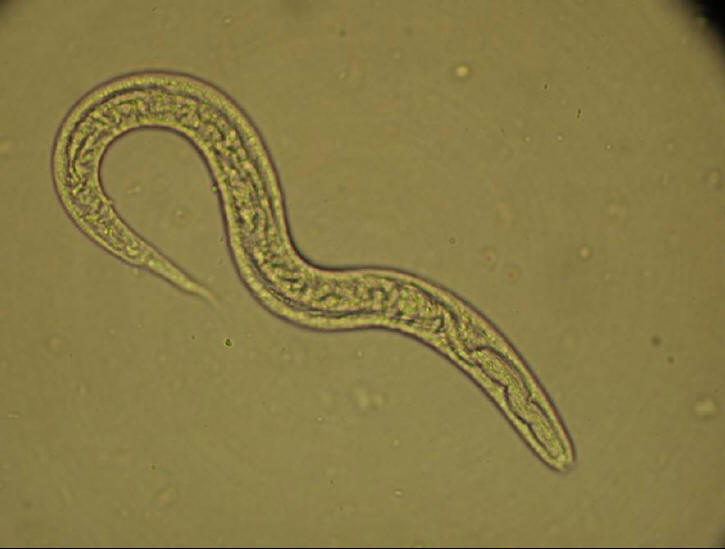 Cutaneous Larva Migrans & Larva Currens - Derm101