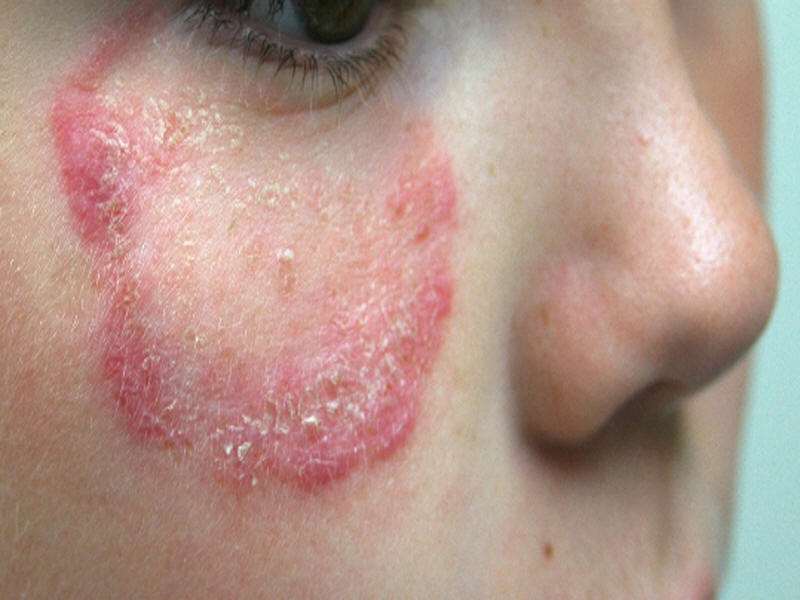 Doxycycline side effects itchy rash - Order affordable drugs at the 